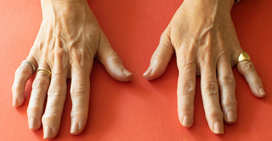 7 Lies about Arthritis that keep you in pain!